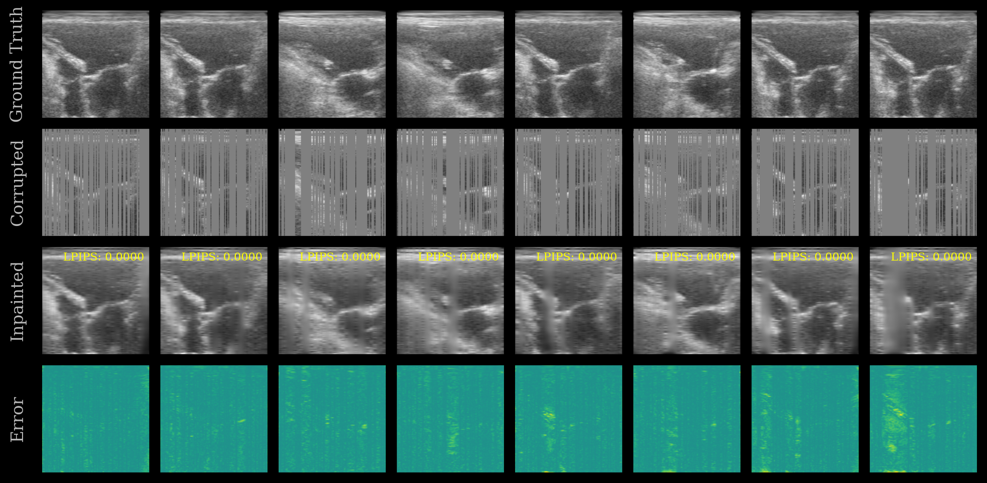 UNet Inpainting Results