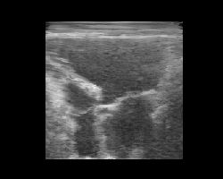 Latent interpolation